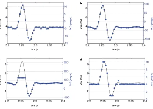 Figure 7. The analogue signal (solid line – left axis) and the sampled version (• – right axis) sampled at 200 Hz