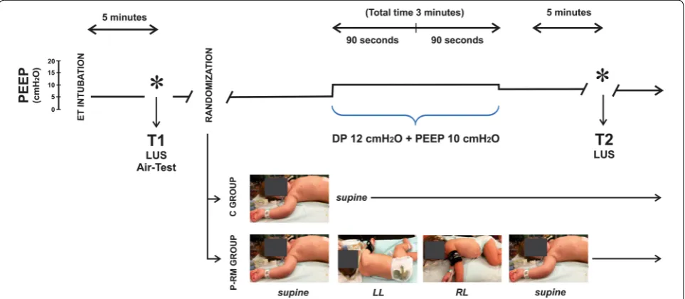 Fig. 1 Diagram of the protocol. Ventilation was switched to pressure control mode using 12 cmHgroup (P-RM group) were turned to the left lateral position (LL) during 90 s and then to the right lateral (RL) for another 90 s, to finally reach the supine posi
