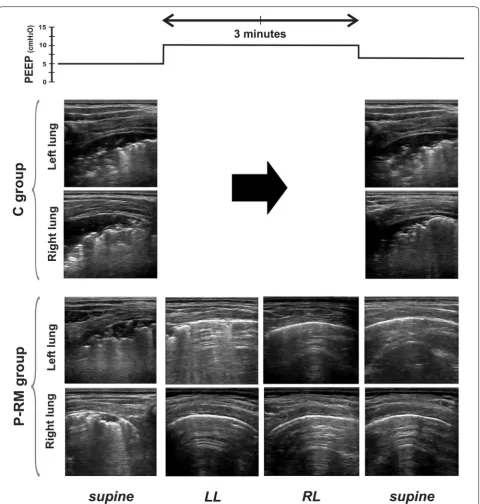 Fig. 4 Example of the protocol in one representative patient per group. LUS images were assessed in the posterior areas in supine (dorsal lung) and in the uppermost areas in the lateral positions (ventral lung)