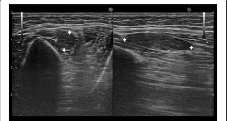 Fig. 15 along with soft tissue oedema.