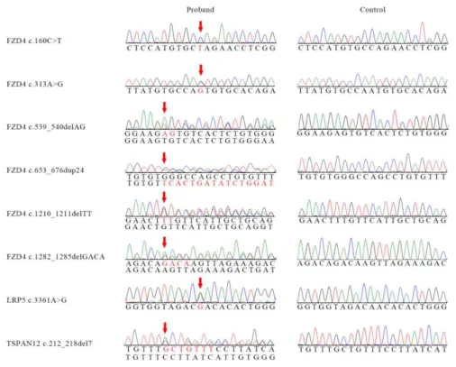 Fig 1. Sequence electropherogram of 8 pathogenic mutations. 