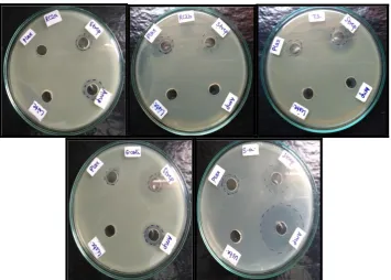 Figure. 5: Antimicrobial activity of 70% ethanol and its comparison to positive controls