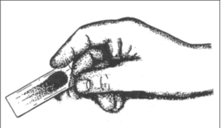 Figure 3-5c, Side method for preparation of blood films: Finished slide. 