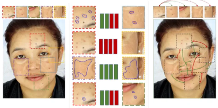 Figure 1. The concept of object-by-object learning: In fact, skin lesion objects have visual relations between each other where it helps easily human to judge about what type of skin lesions are.