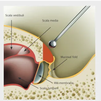 Figure 39 RW niche anatomy