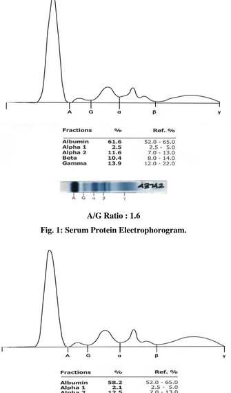 Fig. 1: Serum Protein Electrophorogram. 