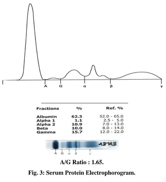 Fig. 3: Serum Protein Electrophorogram. 
