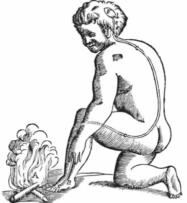Figure 1. An early drawing of a pain pathway taken from Descartes (166411972) "Traite de l' homme "