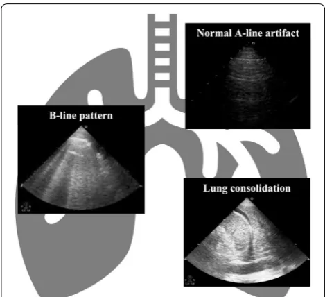 Fig. 1 Different echographic patterns during lung ultrasound evaluation