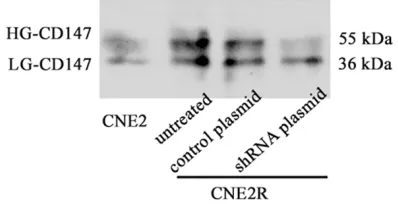 Figure 5. Effects of GnT-V knockdown on the formation of β1, 6-branched N-Glycans. CNE2R cells were stably transfected with the GnT-V shRNA plasmid or the control plasmid