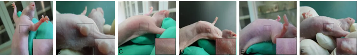 Figure 5. Robo protein in T24 cells by immunofluorescence staining. (A) Hoechst staining, (B) Hoechst staining, (C) Immunofluorescent staining of Robo1 protein in T24 cells, (D) Immunofluorescent staining of Robo4 protein in T24 cells, (E) Synthesized by (