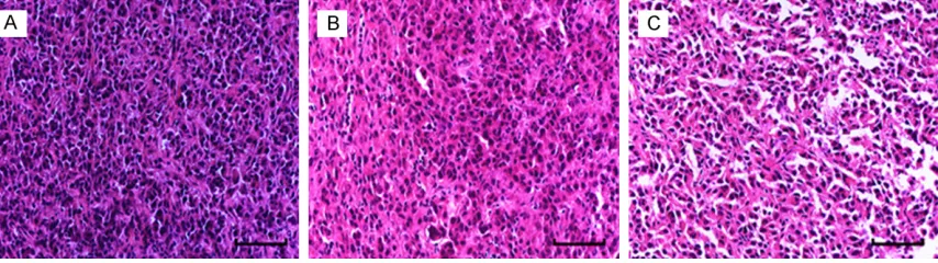Figure 7. HE staining of tumor tissue in nude mice. A: Control group; B: Robo1 blocking group; C: Robo4 blocking group