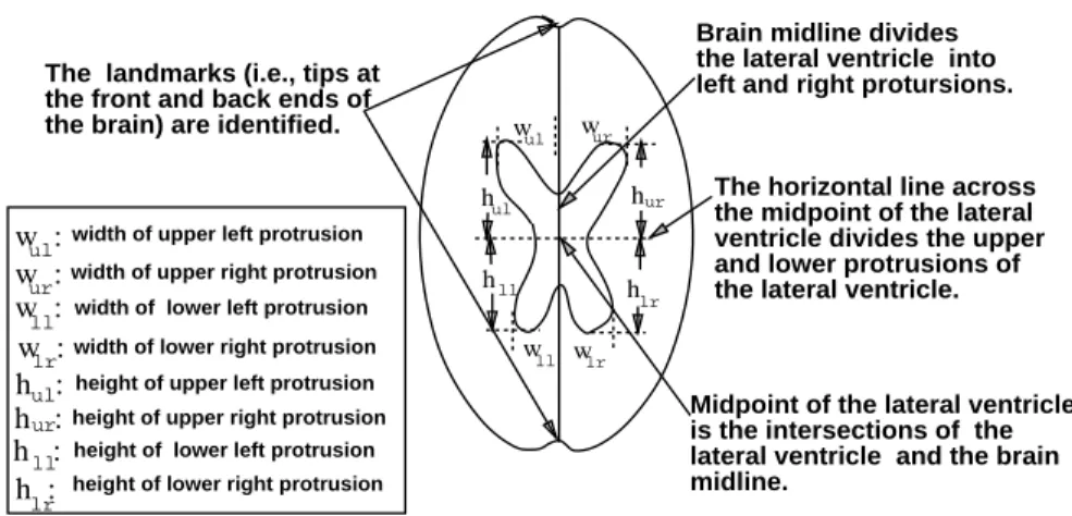 Figure 6-2 For more precise shape description, the shape model decomposes a lateral ventricle into four natural sub-structures: upper left substructure, upper right substructure, lower left substructure, and lower right substructure.