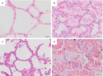 Figure 1. Histopathological changes in H&E-stained lung tissues of severe falciparum malaria patients