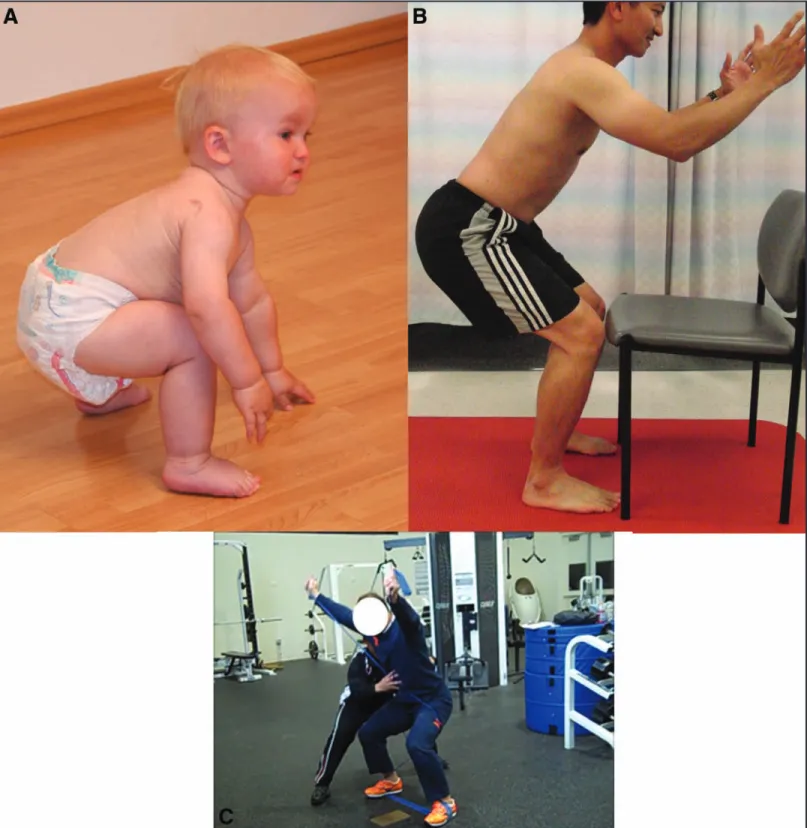Figure 10.  (A) Deep Squat position corresponding to 16 months of age. (B) Training for good squat pattern to avoid “quad domi- domi-nant” pattern where the knees move anterior of the feet