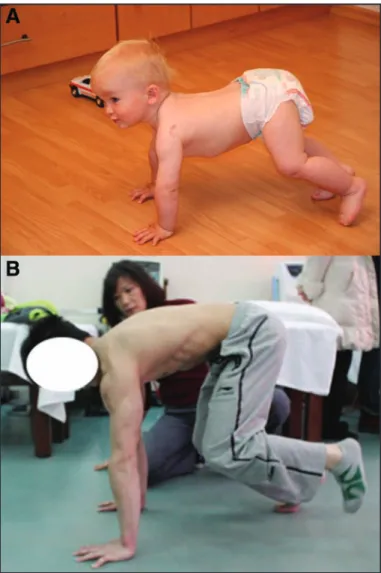 Figure 9. (A) Bear position corresponding to 14 months of  age. (B) Training of an athlete in a bear position from 4 to 3  points of support when he lifts his left foot off the ground