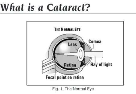 Fig. 1: The Normal Eye