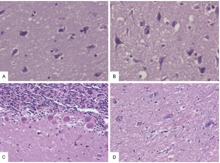 Figure 3. Severe spongiosis in the cerebrum (A) (HE × 200); Neurons of thalamus PAS (+) (B) (× 200).