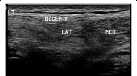 Fig. 1 In patient with LGMD2B, ultrasound detected preferentialaffection of both heads of biceps brachii