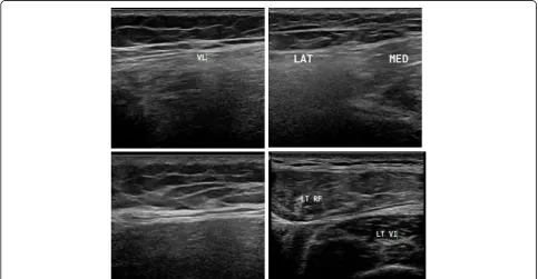 Fig. 2 Muscle ultrasound in patient with limb girdle muscular dystrophy 2A (LGMD2A) showing in the thigh more affection of posterior compartmentwith predominant affection of the adductors, in the leg more affection of medial head of gastrocnemius (MED GASTRO) and soleus (SOL) more thanlateral head with relative sparing of tibialis anterior (TA)