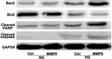 Figure 4. The expression level of MMP9 at mRNA and protein levels under different concentrations of glucose