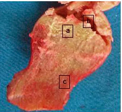 Figure 1. Femoral head tissue sample. a. Necrotic bone tissues; b. Breakage of cartilage; c