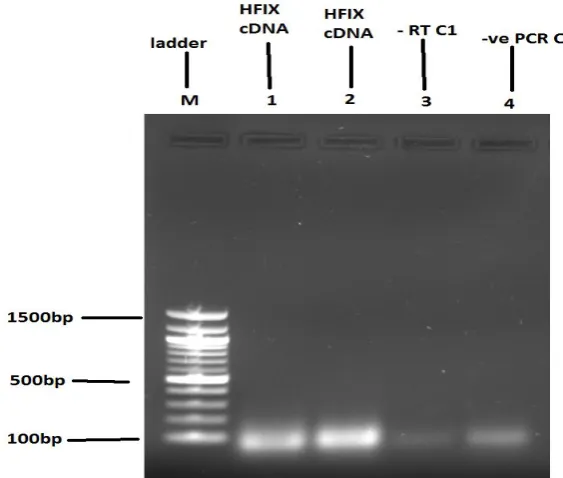 FIGURE 3: Gel electrophoresis showing no visible cDNA amplification of hFIX gene.  Lane 1 (hFIX cDNA with primers designed from exon 2), 2 (hFIX cDNA with primers designed from exon 6), 3 (negative control (-RT) 1 without reverse transcriptase) and 4 (PCR 
