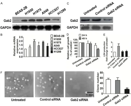 Figure 1. Effects of Gab2 silencing on H1975 cells clone formation. A. Gab2 protein expression in non-small cell lung cancer cell lines and human bronchial epithelial cells BEAS-2B
