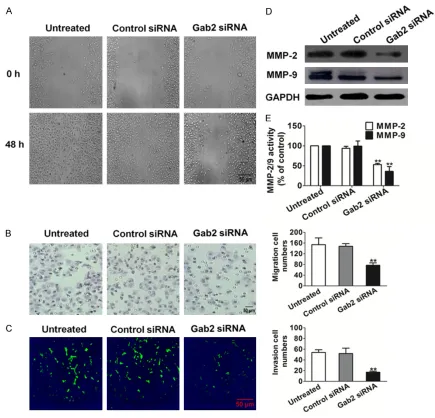 Figure 2. Effects of Gab2 silencing on H1975 cell motility. A. Representative examples of wounding experiment re-fields for each group