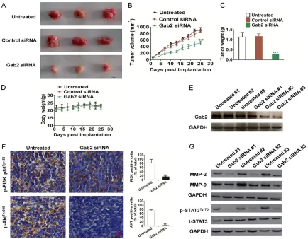 Figure 4. In vivo tumorigenicity of Gab2-siRNA H1975 and untreated H1975 cells. (A) Representative pictures of tumor masses from mice were taken after 25 days of implanted with H1975 cells or with siRNA-Gab2 H1975 cells