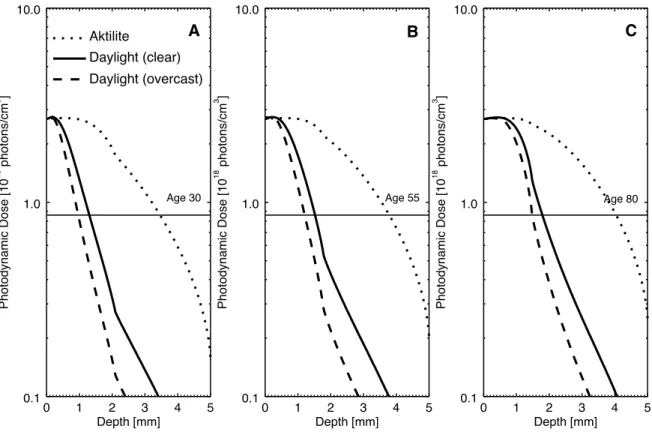 Figure 7: Photodynamic dose corresponding to 75 Jcm −2 for the different light sources at age A) 30, B) 55