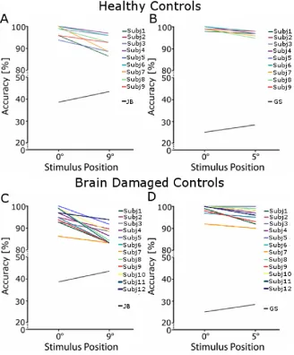 Figure 7. Accuracy in simultaneous object recognition. Patients with SA detected overlapping 
