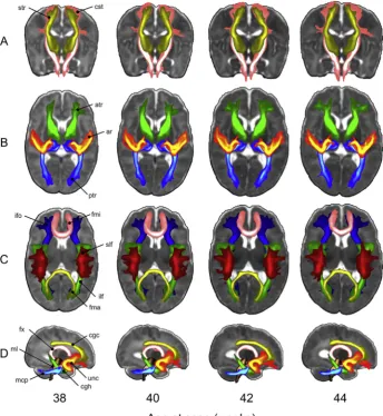 Fig. 11. Automated probabilistic tractography framework. A set of standardized ROIs is deﬁned for week 44