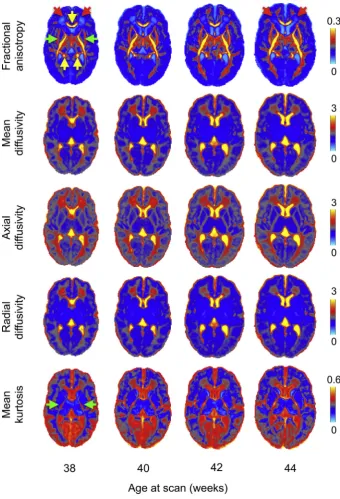 Fig. 8. Outputof thedMRI processingpipelineshowing average DT-derived microstructural measuresfrom 38 to 44 weeks (20 subjects per-age group)