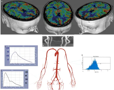 Figure 3: Mechanistic endpoints (‘intermediary outcomes’) assessing brain and systemic vascular function in response to cilostazol and isosorbide mononitrate