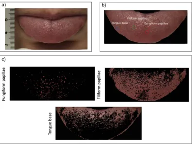 Fig. 1. a) Standardised positioning of the tongue for image capturing, with ruler used to scale images, b) An example of manual selection of the three regions of interest (ROIs) -‘fungiform papillae’, ‘ﬁliform papillae’, and ‘tongue base’, c) Algorithm segmentation of the tongue into ‘fungiform papillae’, ‘ﬁliform papillae’, and ‘tongue base’- based on colourlearning.