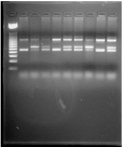 Figure 1. PCR amplification of Jack 2 cases and con-trol.
