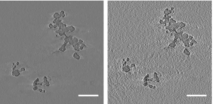 Fig. 4. Comparative slices from FG-WBP-1 (left) and FG-WBP-5 (right) tomograms. Images are not postprocessed.