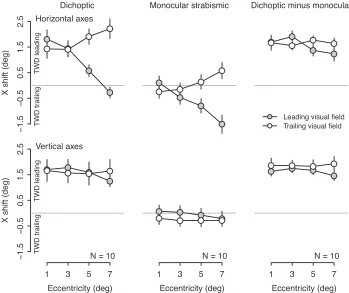 Figure 8. Difference in x shift between the dichoptic and monocular conditions for a subset of subjects who performed the task inboth conditions (five left esotropes, five right esotropes; same subjects as in Figures 4 and 5)