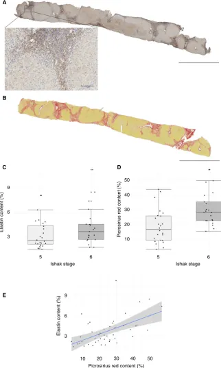 Figure 1. Quantiﬁcation of elastin and ﬁbrosis in biopsies of advanced (Ishak stagePchronic hepatitis C virus infections and advanced stage (Ishak stagered (PSR); representative whole-slide images of a single case are shown ( ≥5) hepatitis C virus infectio