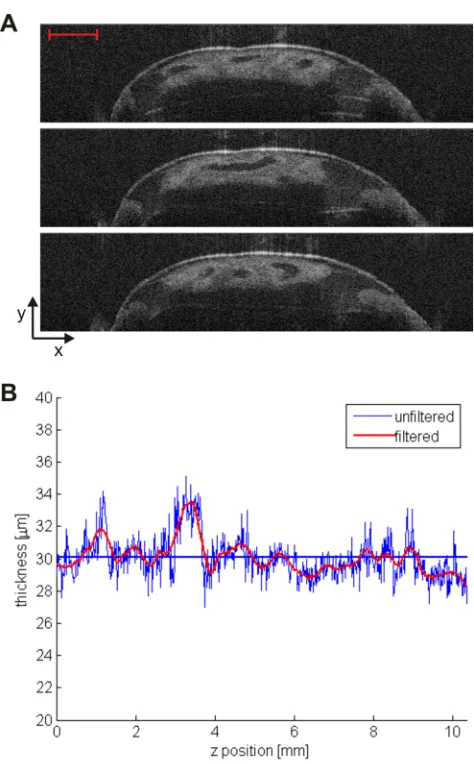 Figure 2. OCT images of krill carapace and pleopod joint. (A) OCT spatial reference frame axes with respect to krill position