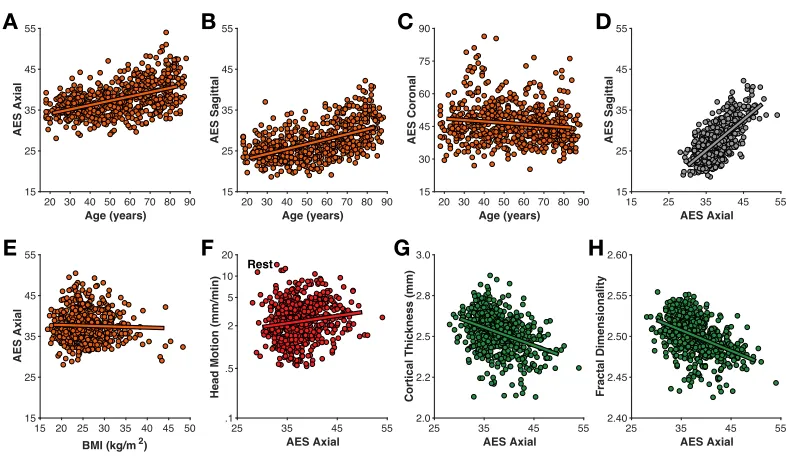 Figure 2Averaged time-course of head motion for rest (red) and movie (blue) fMRI scans for young(A) and older adults (B)