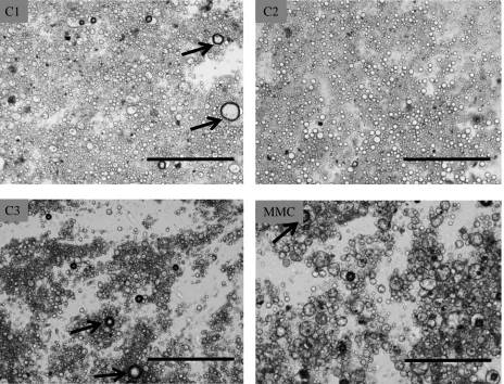 Figure 2: Chocolate bolus bright field images. The arrows point out air bubbles. The scale bar in each image represents400 m.
