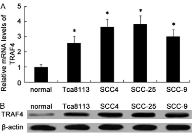 Figure 1. The up-regulation of TRAF4 was observed in OSCC cell lines. The mRNA levels of TRAF4 in four OSCC cell lines (Tca8113, SCC-4, SCC-25 and SCC-9) and human normal oral keratinocyte cell lines HOK (used as normal) were determined by RT-PCR (A)