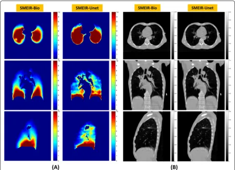 Fig. 7 Comparison of DVFs solved by the SMEIR-Bio and the SMEIR-Unet techniques (a); Comparison of the corresponding motion-compensatedCBCT images reconstructed by the SMEIR-Bio and the SMEIR-Unet techniques (b)