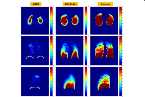 Fig. 5 Comparison between the fine details in the CBCT images reconstructed by the FDK, ART-TV, SMEIR and SMEIR-Bio techniques, by using the“Ground-truth” 4D-CT reference phase image for evaluation