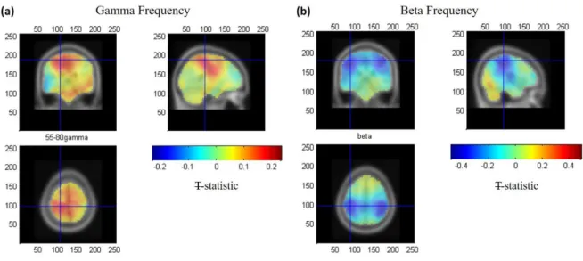Figure  5.  Group  average  (N=10)  T-statistic  beamformer  maps  showing  regions  exhibiting 