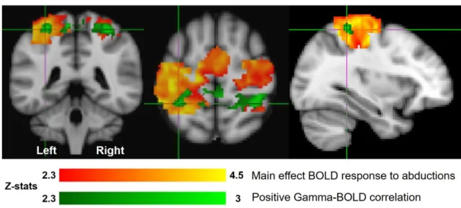 Figure 7. Group  average (N=10)  fMRI mixed effects  results.  Positive correlation  of  BOLD 