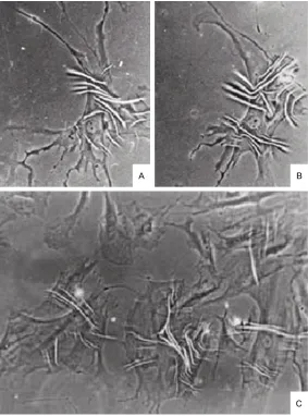Figure 8. LSC-1 cell contraction induced by endothelin-1. A: Before ET-1 administration (original magnification, ×400)