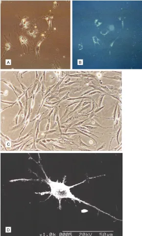 Figure 1. A: HSCs contain lipid droplets in the perinuclear zone (original mag-nification, ×200)